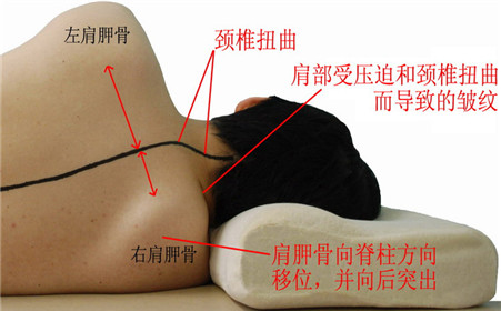 怎样训练良好姿势预防颈椎病