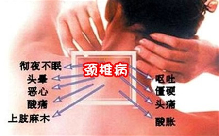 患了颈椎病的要如何护理