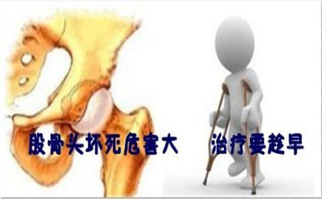 患上股骨头坏死常见的症状