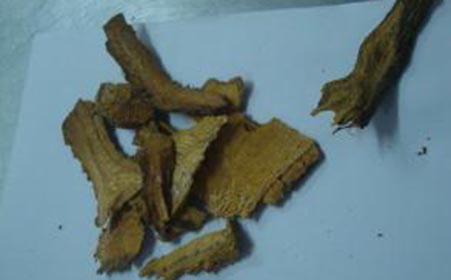 如何护理关节炎患者